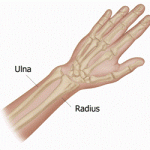 Raleigh Broken Wrist Attorney
